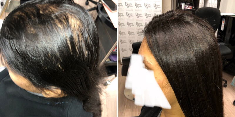 Hair Integration Before And After